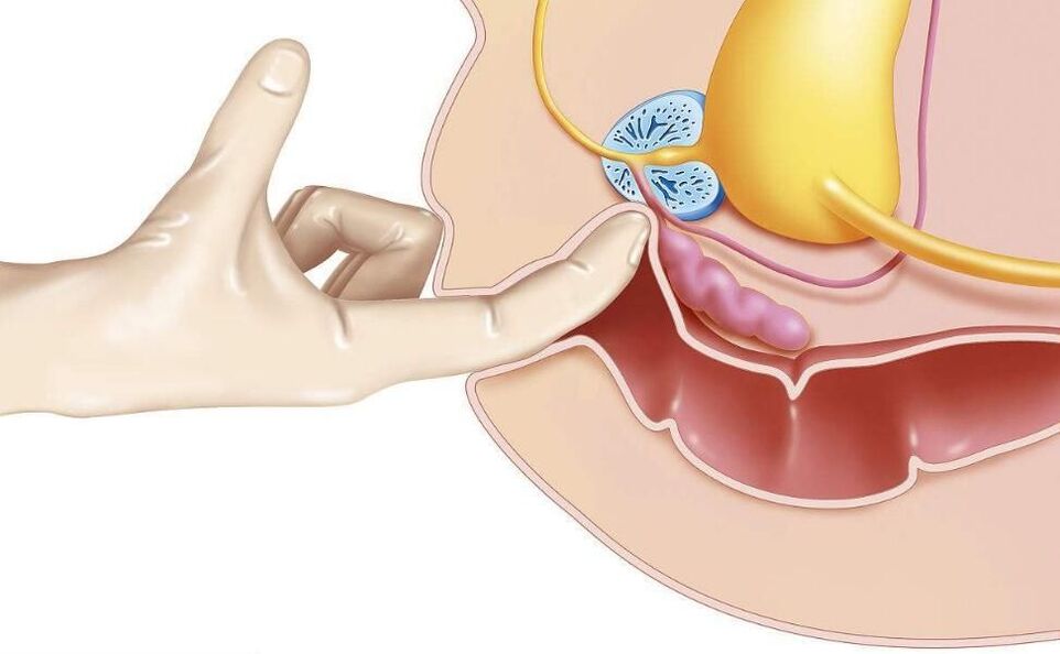 masaža prostate