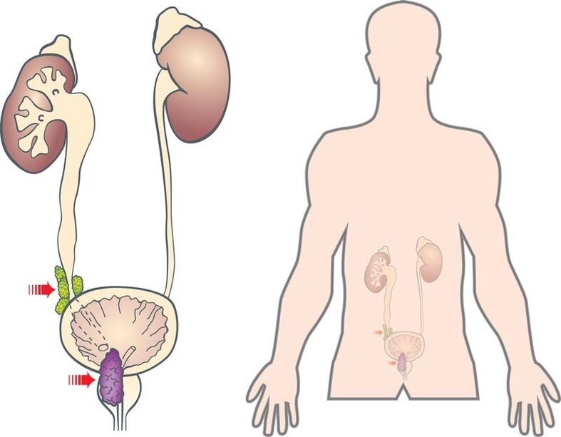 Simptomi in vzroki adenoma prostate